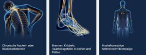 Mehr über den Artikel erfahren Nervenschmerzen – Symptome, Ursachen und Behandlung