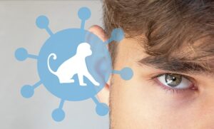 Mehr über den Artikel erfahren mPox – Die Show geht weiter