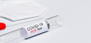 Mehr über den Artikel erfahren Aktuelle deutsche Studie zeigt: Der PCR-Test entlarvt sich als politischer Schwindel